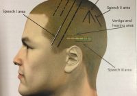 Featured image for The History of Acupuncture: A Long Journey to Health