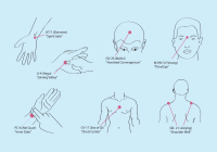 Featured image for Acupuncture for Mental Wellness: Balancing Mind and Spirit