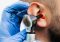 Featured image for Acupuncture for Tinnitus: Quiet the Ringing in Your Ears