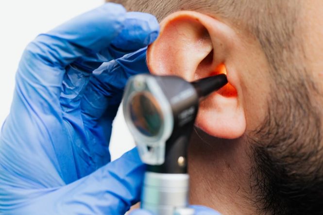 Featured image for Acupuncture for Tinnitus: Quiet the Ringing in Your Ears