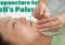 Featured image for Acupuncture for Bell's Palsy: Restore Facial Function