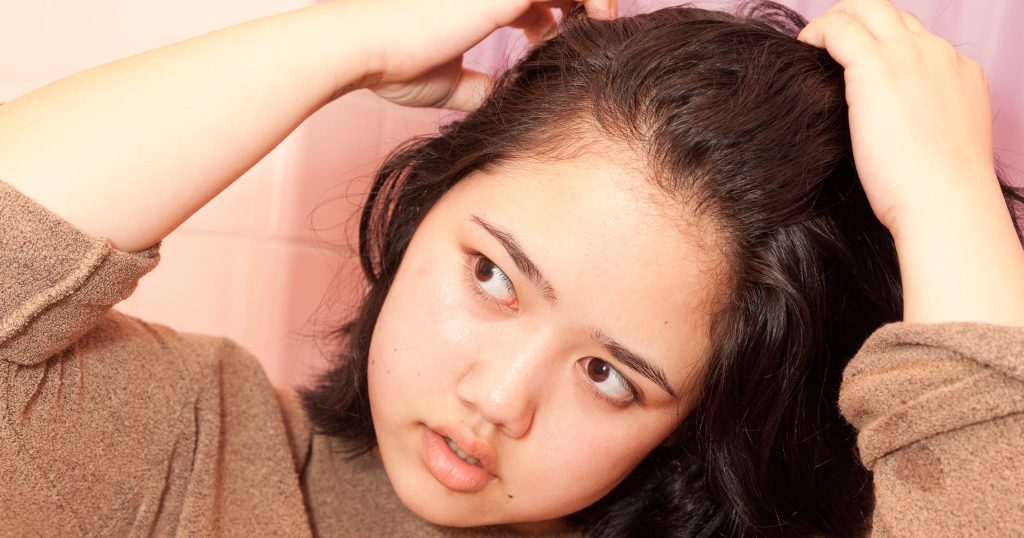Content image for How to Get Rid of Oily Hair