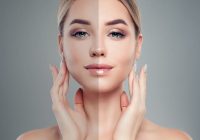 Featured image for Cheek Augmentation: Enhancing Cheekbones for a Youthful Look