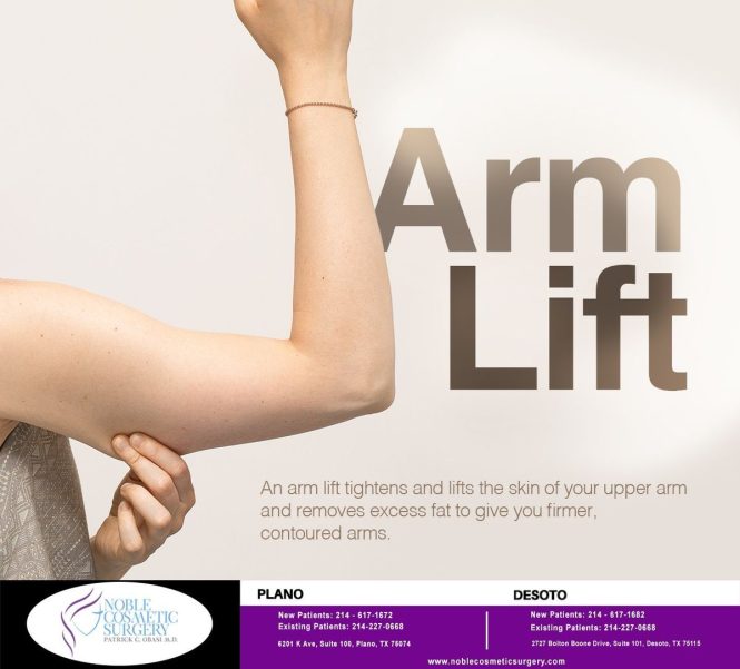 Featured image for Arm Lift Surgery (Brachioplasty): Tightening Loose Arm Skin