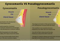 Featured image for Male Breast Reduction (Gynecomastia Surgery): Reducing Chest Fat
