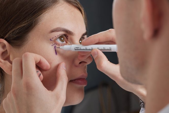 Featured image for Eyelid Surgery for Men: Rejuvenating Tired Eyes